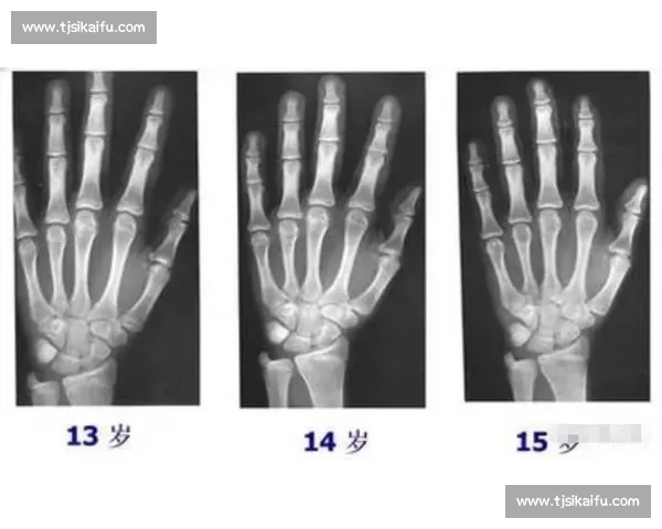 18 岁骨骺线未闭合?科学 3 招助你再长高 5cm 18 岁骨骺线未闭合?科学 3 招助你再长高 5cm